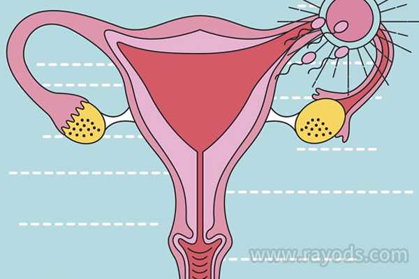 助孕怎么提取精子和卵子_助孕怎么受精啊_卵巢早衰能做试管婴儿吗？卵巢早衰