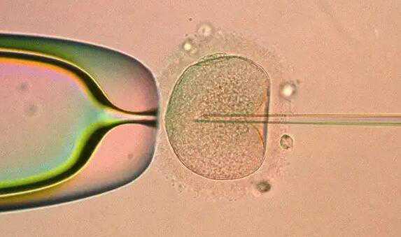 三明有没有愿代孕的_三明哪家医院可以做代孕试管_1.5毫升精液有多少个精子？